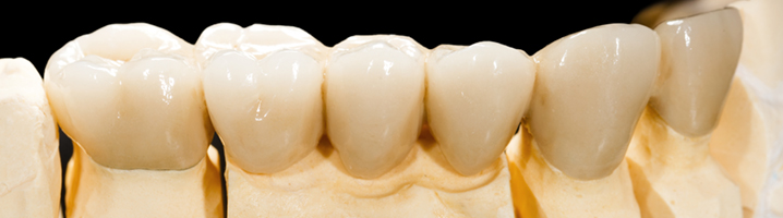 dentalbridge-banner