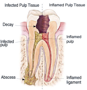 tooth-ache-figure-2