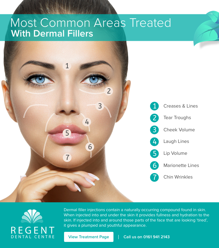 Most common areas treated with dermal fillers